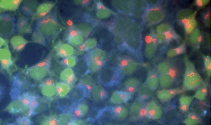 mikroskopische Visualisierung rekombinanter Zelllinien in Kultur, die nach genetischer Modifikation das DOM-7 Protein (Rot) der Maus und das Grüne Fluoreszenz Protein (GFP; Grün) produzieren. Außerdem wurde das Organell Endoplasmatisches Retikulum (Blau) der Zellen angefärbt.