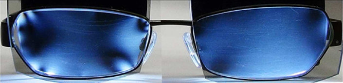 Eine Brille mit blauen Gläsern; das linke sieht an den Rändern verbogen aus.
